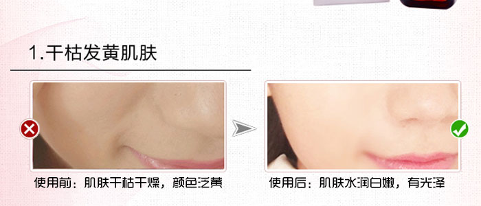 隆麗琦本草潤(rùn)白修復(fù)霜套盒 隆麗琦本草潤(rùn)白修復(fù)霜套盒