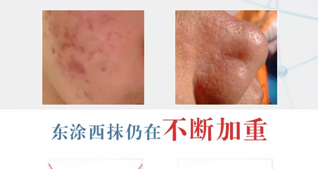 �wʿ�_�����r�������o(h��)���ɷ�+�����r�������o(h��)��øҺ