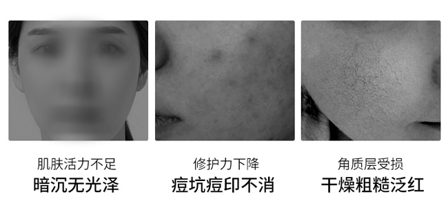 ���ɷ��׺�