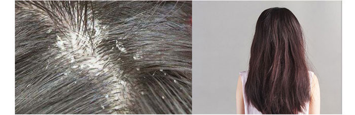 茶氏家族-古樹(shù)山茶麩洗發(fā)乳 茶氏家族-古樹(shù)山茶麩洗發(fā)乳