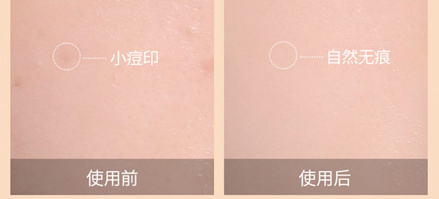 ��ȷ��o����BB˪