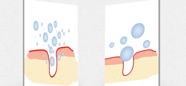 �������������o(h��)ԭҺ