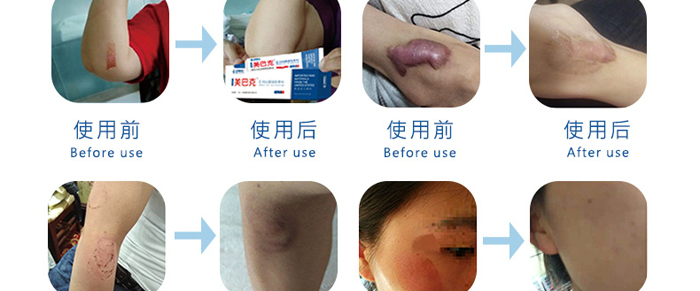 �����t(y��)�����Ϳ��t(y��)�ù�ͪ���z����