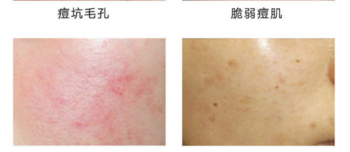 ���B(y��ng)���������o��