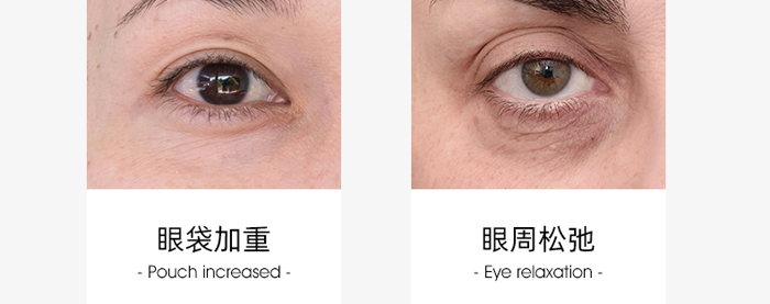 ِ�������Kͯ�����˪