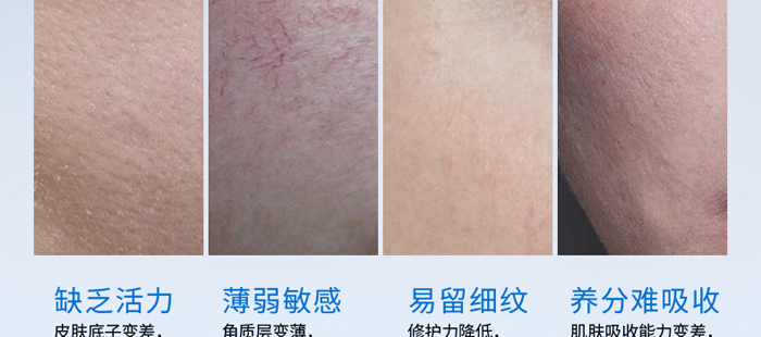 ��ޢѩ�����AҺ